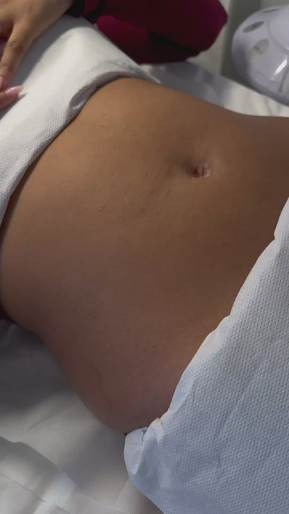 Formation Lipocavitation et Radiofréquence (machine inclus)